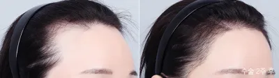 Before & After
