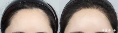 Before & After
