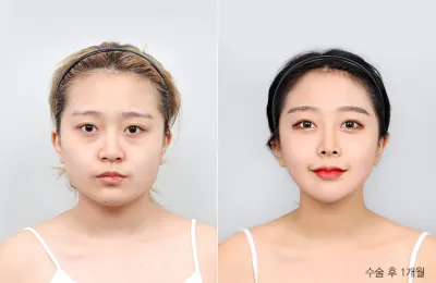 Before & After