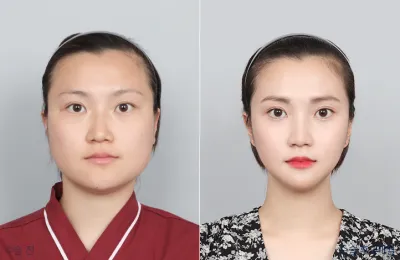 Before & After