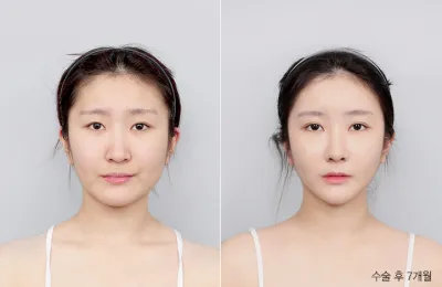 Before & After
