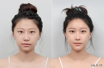Before & After