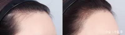 Before & After
