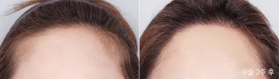 Before & After