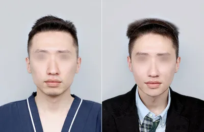 Before & After