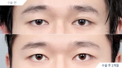 Before & After