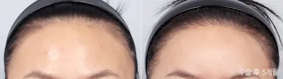 Before & After