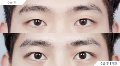 Before & After