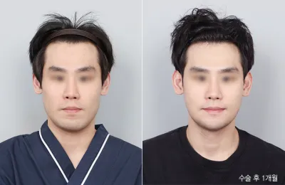 Before & After
