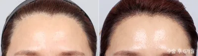 Before & After