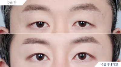 Before & After