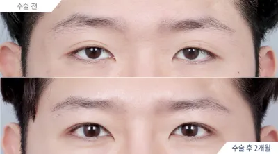 Before & After
