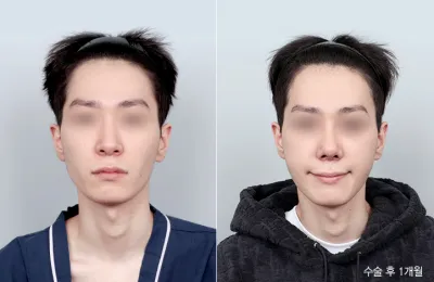 Before & After