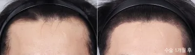 Before & After