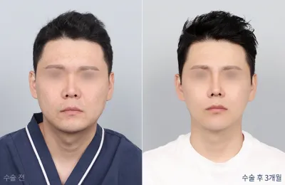 Before & After
