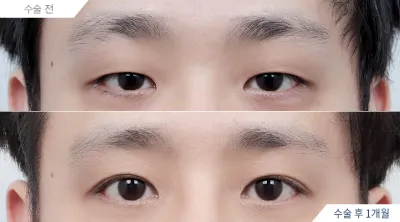Before & After