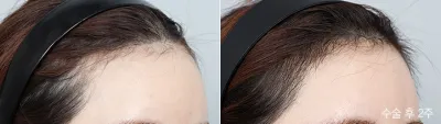 Before & After
