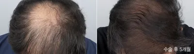 Before & After