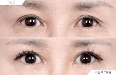 Before & After