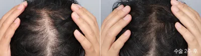 Before & After