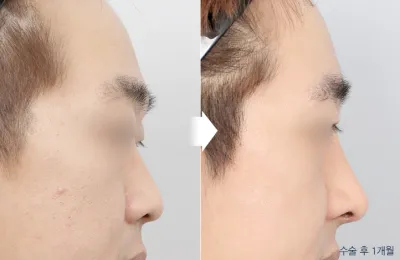 Before & After