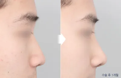 Before & After