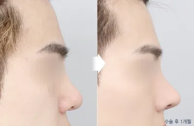 Before & After