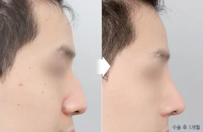 Before & After