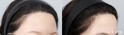 Before & After