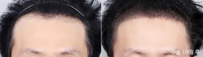 Before & After