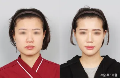 Before & After