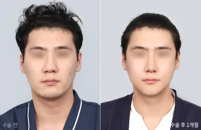 Before & After