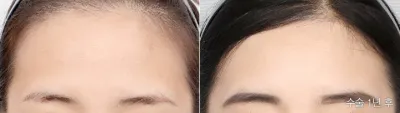 Before & After