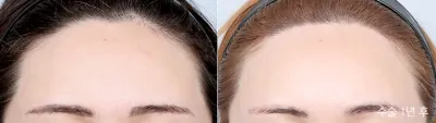 Before & After