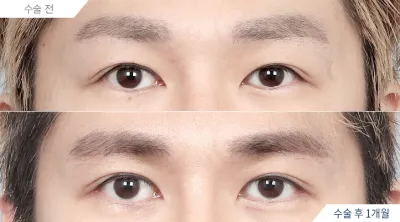 Before & After