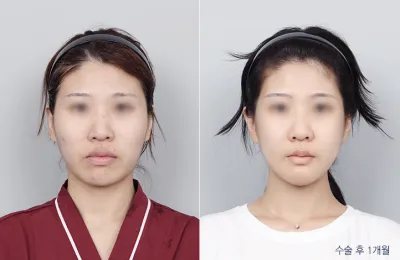 Before & After