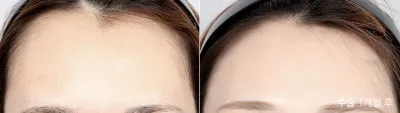 Before & After