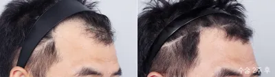 Before & After