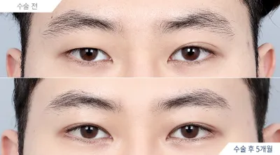 Before & After