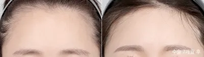 Before & After