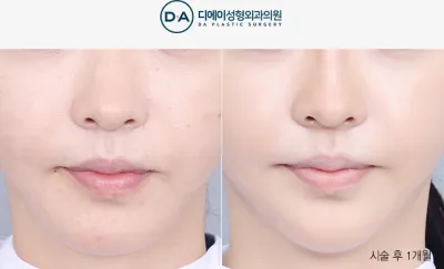Before & After