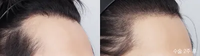 Before & After