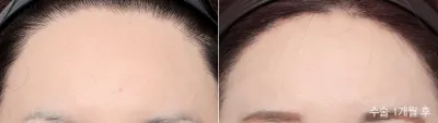 Before & After