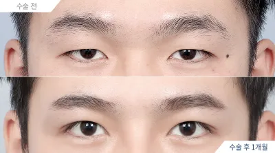 Before & After