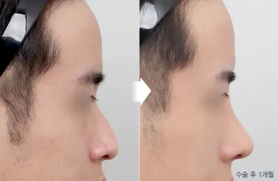 Before & After
