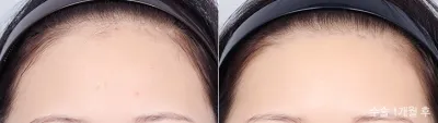 Before & After
