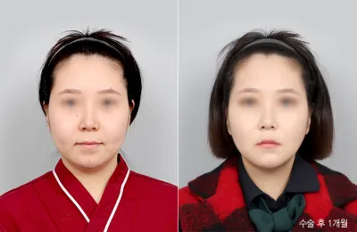 Before & After
