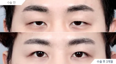 Before & After