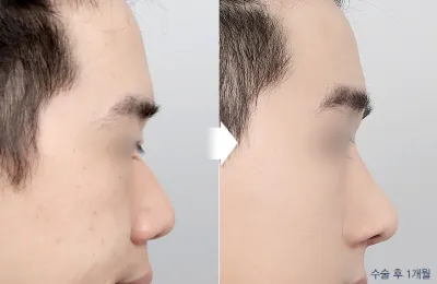 Before & After