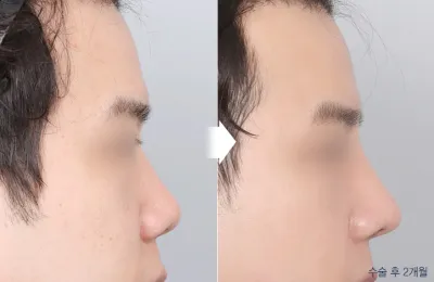 Before & After